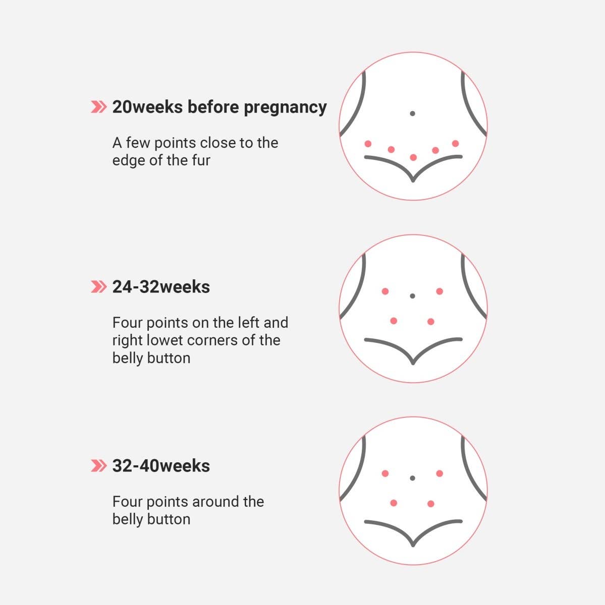 SpringBud FD-400B Fetal Doppler Heart Beat Monitor